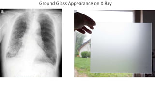 Occupational Health part 1