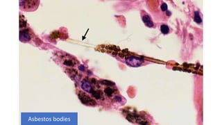 Occupational Health part 1