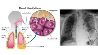 Occupational Health part 1