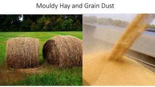 Occupational Health part 1