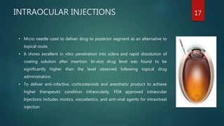 Intraoccular Injection For Occular dds by pradipkumar rathod | PPTX