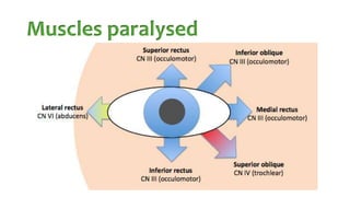Muscles paralysed
 