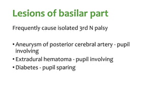 Lesions of basilar part
Frequently cause isolated 3rd N palsy
• Aneurysm of posterior cerebral artery - pupil
involving
• Extradural hematoma - pupil involving
• Diabetes - pupil sparing
 