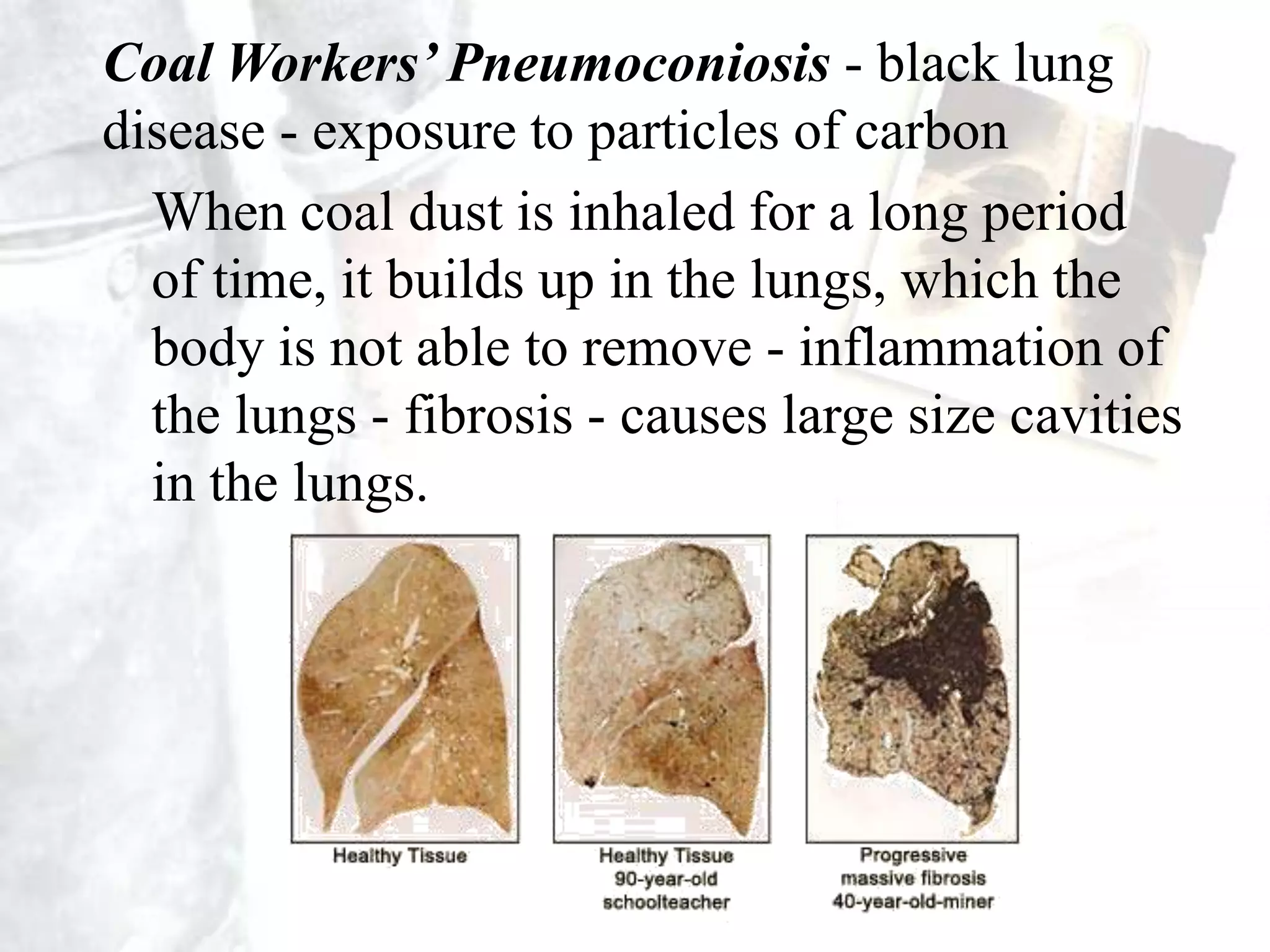 Of 0.7 million deaths in the world, 0.12 (17%) from India