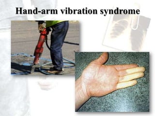 So, deaths from such diseases - difficult to enumerateSome Numbers...WHO - 100 million occupational injuries  0.1 million deaths in the world