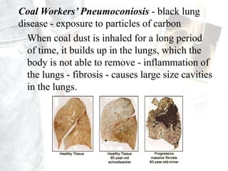 Of 0.7 million deaths in the world, 0.12 (17%) from India