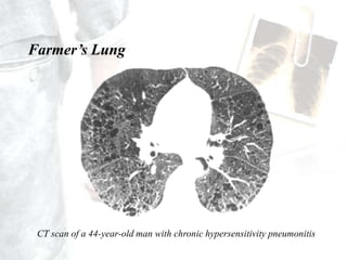 a delay of weeks to months with lead poisoning