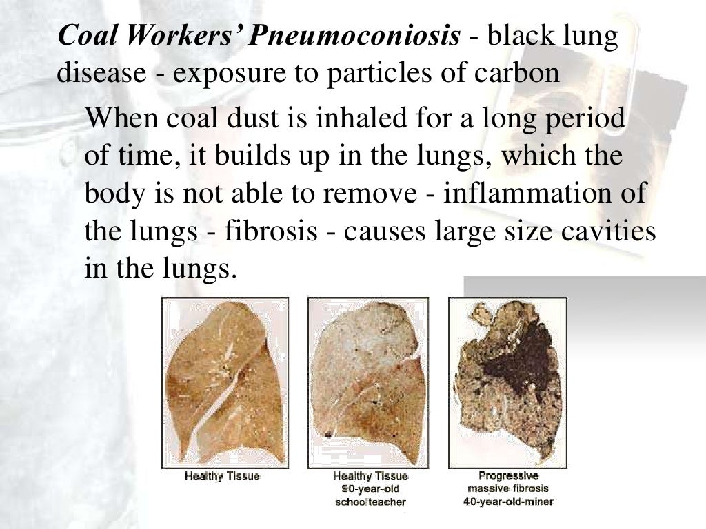 Occupational Diseases