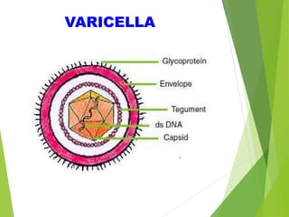 VARICELLA
 