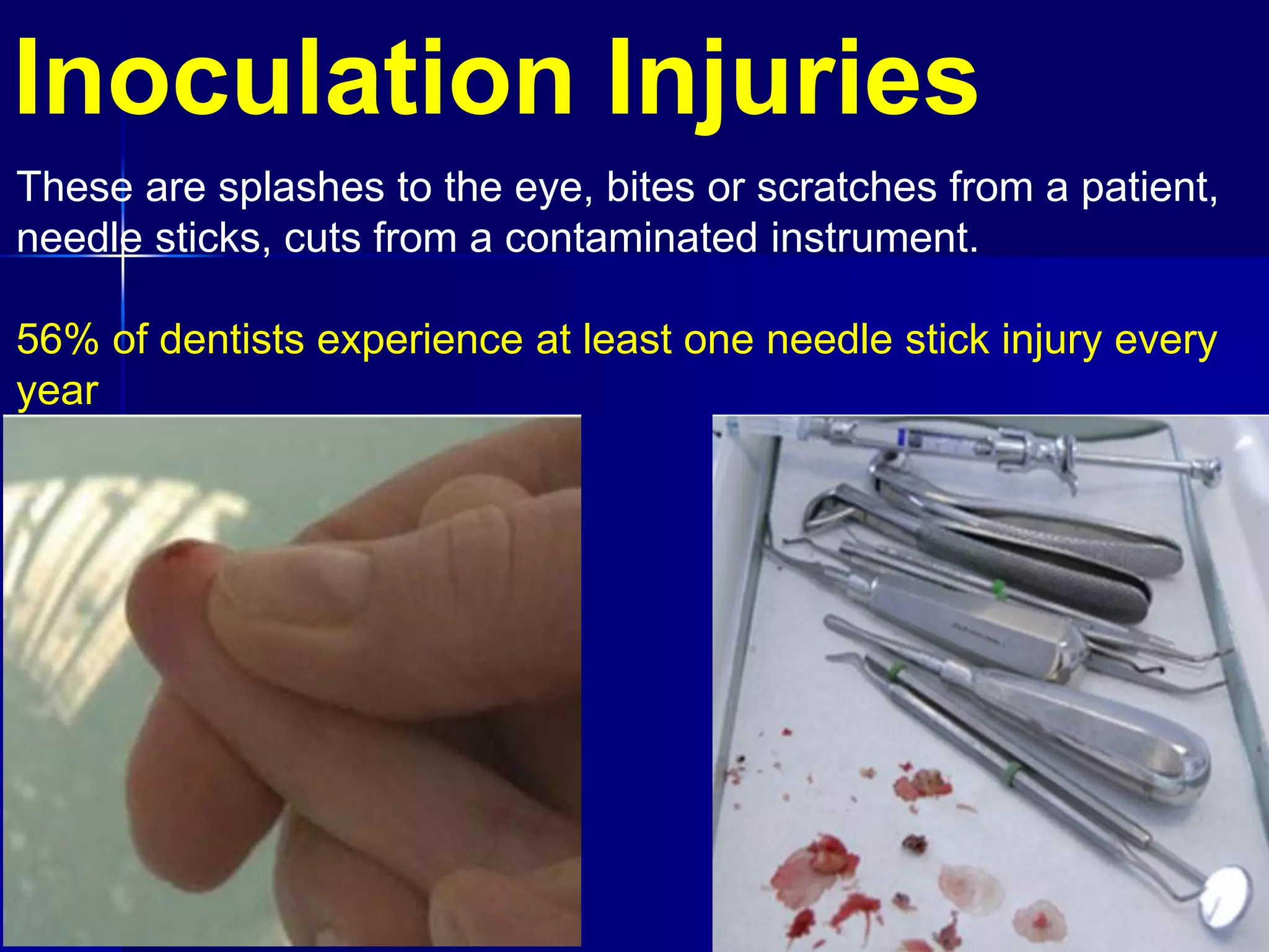 Occupational hazardes in dentistry | PDF