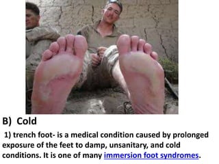 B) Cold
1) trench foot- is a medical condition caused by prolonged
exposure of the feet to damp, unsanitary, and cold
conditions. It is one of many immersion foot syndromes.

 