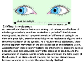 2) Miner’s nystagmus

An occupational disease that occurs among coal miners, usually those of
middle age or elderly, who have worked for a period of 25 to 30 years
underground. Its physical symptoms consist of difficulty of seeing in the
dark or in poor light, excessive sensitivity to and intolerance of glare, and a
rhythmic oscillation of the eyeballs. As a result of these oscillations, there
may be apparent movement of the objects looked at and defective vision.
Associated with these ocular symptoms are other general disorders, such as
headaches and dizziness, particularly after stooping or bending, and the
development of psychoneurotic symptoms is common in the later stages of
the disease. If the disease is not checked, the nervous disorders may
become so severe as to render the miner totally disabled.

 