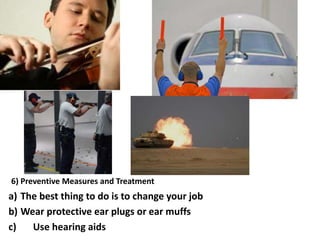 6) Preventive Measures and Treatment

a) The best thing to do is to change your job
b) Wear protective ear plugs or ear muffs
c)
Use hearing aids

 