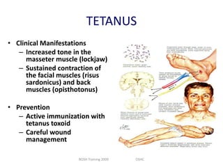 TETANUS
• Clinical Manifestations
– Increased tone in the
masseter muscle (lockjaw)
– Sustained contraction of
the facial muscles (risus
sardonicus) and back
muscles (opisthotonus)
• Prevention
– Active immunization with
tetanus toxoid
– Careful wound
management
BOSH Training 2009

OSHC

 