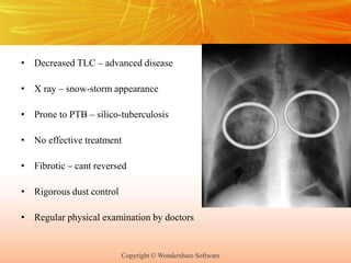 Copyright © Wondershare Software
• Decreased TLC – advanced disease
• X ray – snow-storm appearance
• Prone to PTB – silico-tuberculosis
• No effective treatment
• Fibrotic – cant reversed
• Rigorous dust control
• Regular physical examination by doctors
 