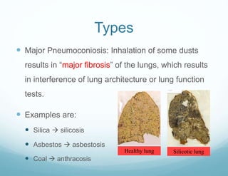 Types
 Major Pneumoconiosis: Inhalation of some dusts
results in “major fibrosis” of the lungs, which results
in interference of lung architecture or lung function
tests.
 Examples are:
 Silica  silicosis
 Asbestos  asbestosis
 Coal  anthracosis
Healthy lung Silicotic lung
 