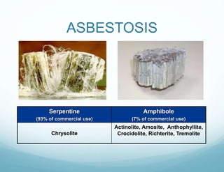 Serpentine
(93% of commercial use)
Amphibole
(7% of commercial use)
Chrysolite
Actinolite, Amosite, Anthophyllite,
Crocidolite, Richterite, Tremolite
ASBESTOSIS
 