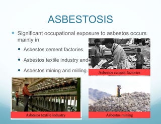 ASBESTOSIS
 Significant occupational exposure to asbestos occurs
mainly in
 Asbestos cement factories
 Asbestos textile industry and
 Asbestos mining and milling. Asbestos cement factories
Asbestos textile industry Asbestos mining
 