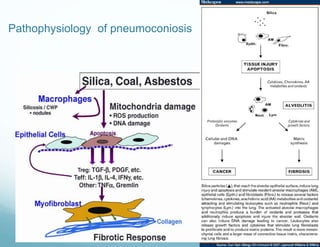 Pathophysiology of pneumoconiosis
 