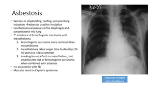 Asbestosis
• Workers in shipbuilding, roofing, and plumbing
industries asbestos used for insulation
• Calcified pleural plaques in the diaphragm and
posterolateral mid lung
• ↑ incidence of bronchogenic carcinoma and
mesothelioma
1. bronchogenic carcinoma more common than
mesothelioma
2. mesothelioma takes longer time to develop (25-
40 years) so is less common
3. smoking has no effect on mesothelium, but
amplifies the risk of bronchogenic carcinoma
when combined with asbestos
• No association with TB
• May also result in Caplan's syndrome
Asbestos-related
pleural plaques
 