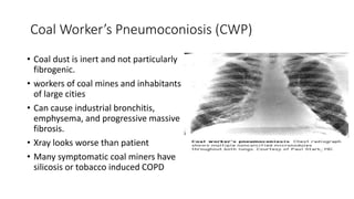 Coal Worker’s Pneumoconiosis (CWP)
• Coal dust is inert and not particularly
fibrogenic.
• workers of coal mines and inhabitants
of large cities
• Can cause industrial bronchitis,
emphysema, and progressive massive
fibrosis.
• Xray looks worse than patient
• Many symptomatic coal miners have
silicosis or tobacco induced COPD
 