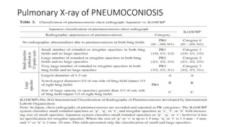 Pulmonary X-ray of PNEUMOCONIOSIS
 
