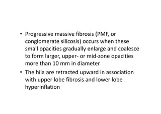 • Progressive massive fibrosis (PMF, or
conglomerate silicosis) occurs when these
small opacities gradually enlarge and coalesce
to form larger, upper‐ or mid‐zone opacities
more than 10 mm in diameter
• The hila are retracted upward in association
with upper lobe fibrosis and lower lobe
hyperinflation
 