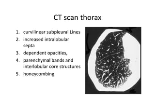 CT scan thorax
1. curvilinear subpleural Lines
2. increased intralobular
septa
3. dependent opacities,
4. parenchymal bands and
interlobular core structures
5. honeycombing.
 