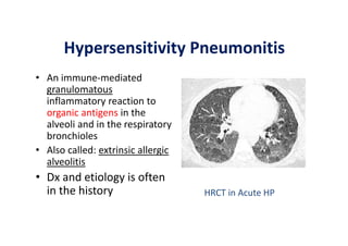 Hypersensitivity Pneumonitis
• An immune‐mediated
granulomatous
inflammatory reaction to
organic antigens in the
alveoli and in the respiratory
bronchioles
• Also called: extrinsic allergic
alveolitis
• Dx and etiology is often
in the history HRCT in Acute HP
 