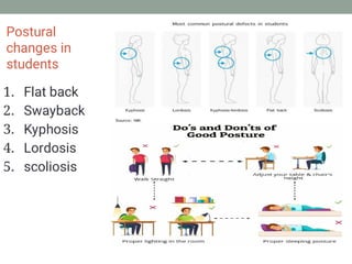 Occupational posture deformity in teachers and students | PDF
