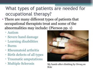 What types of patients are needed for occupational therapy? There are many different types of patients that occupational therapists treat and some of the abnormalities may include: (Pierson pp. 1) Autism Severe hand damage Learning disabilities Burns Rheumatoid arthritis Birth defects of all types Traumatic amputations Multiple Sclerosis My hands after climbing by Orvaq on flckr 