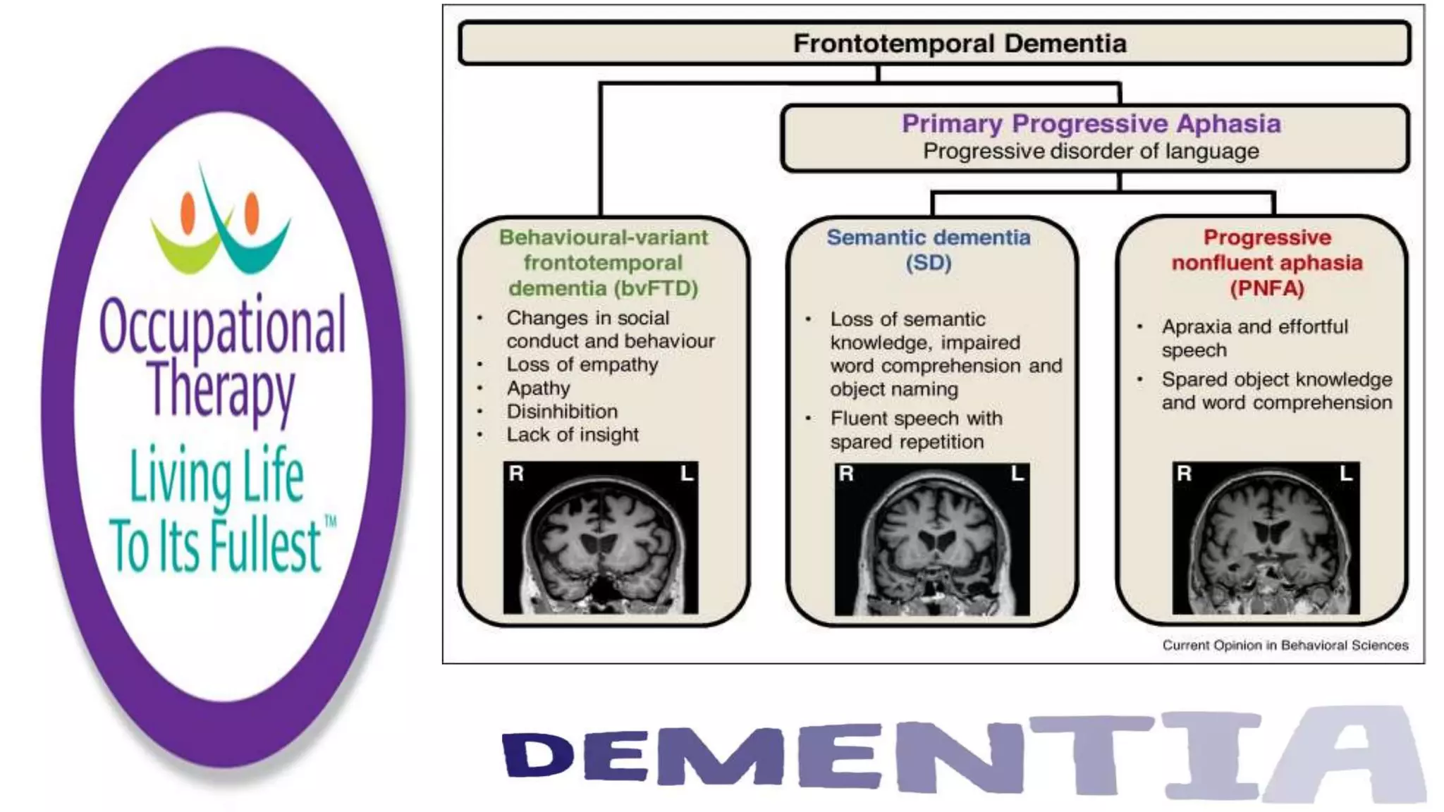 Occupational Therapy and Dementia Care part 2