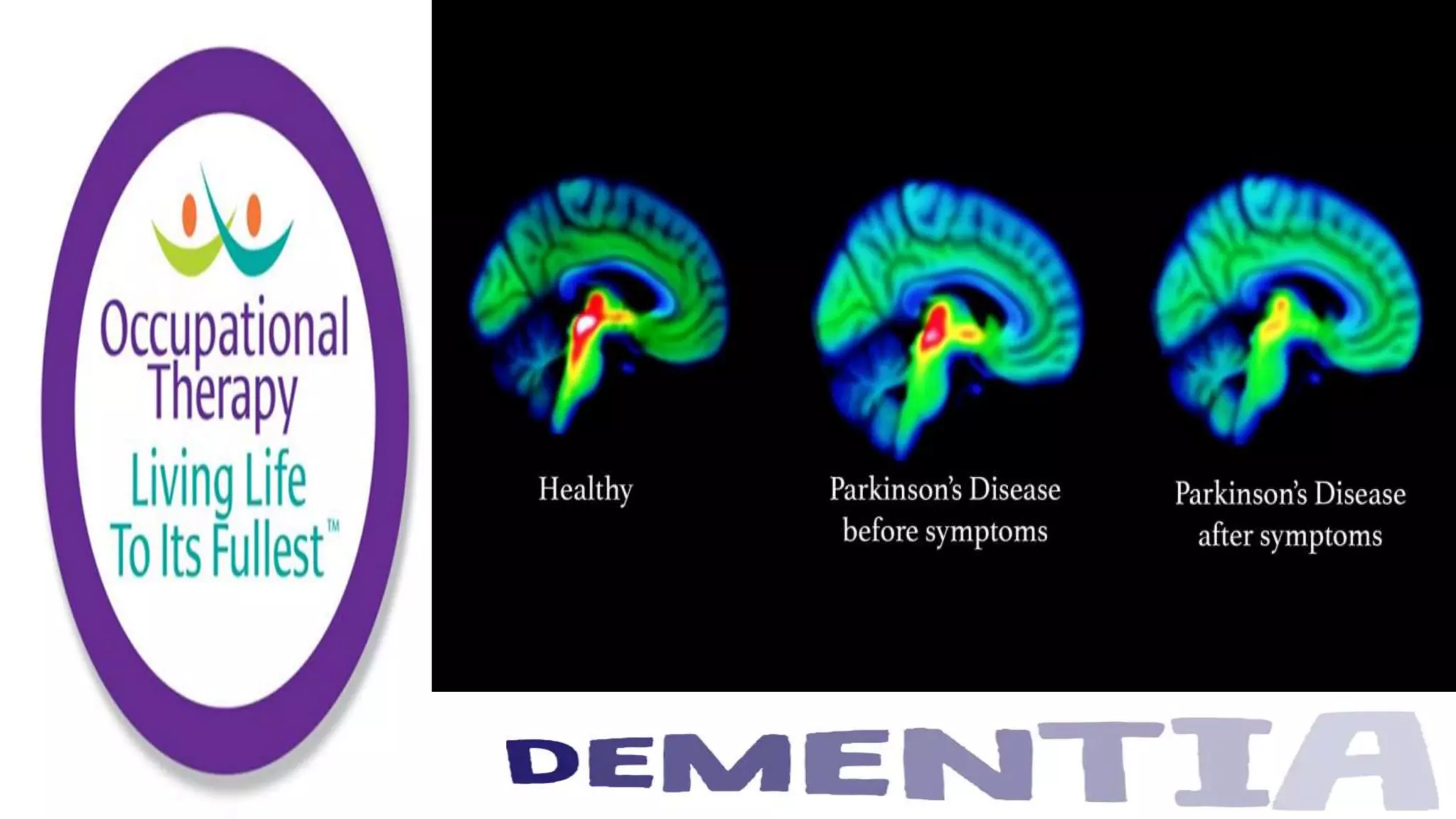 Occupational Therapy and Dementia Care part 2
