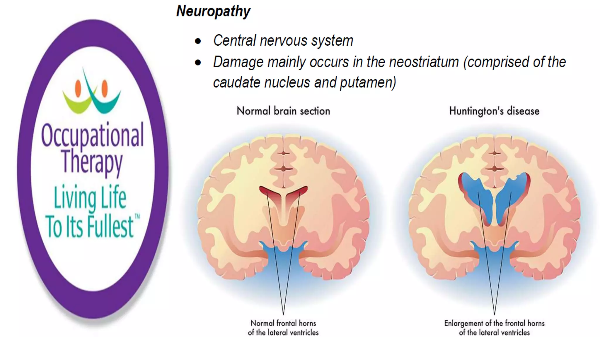 Occupational Therapy and Dementia Care part 2