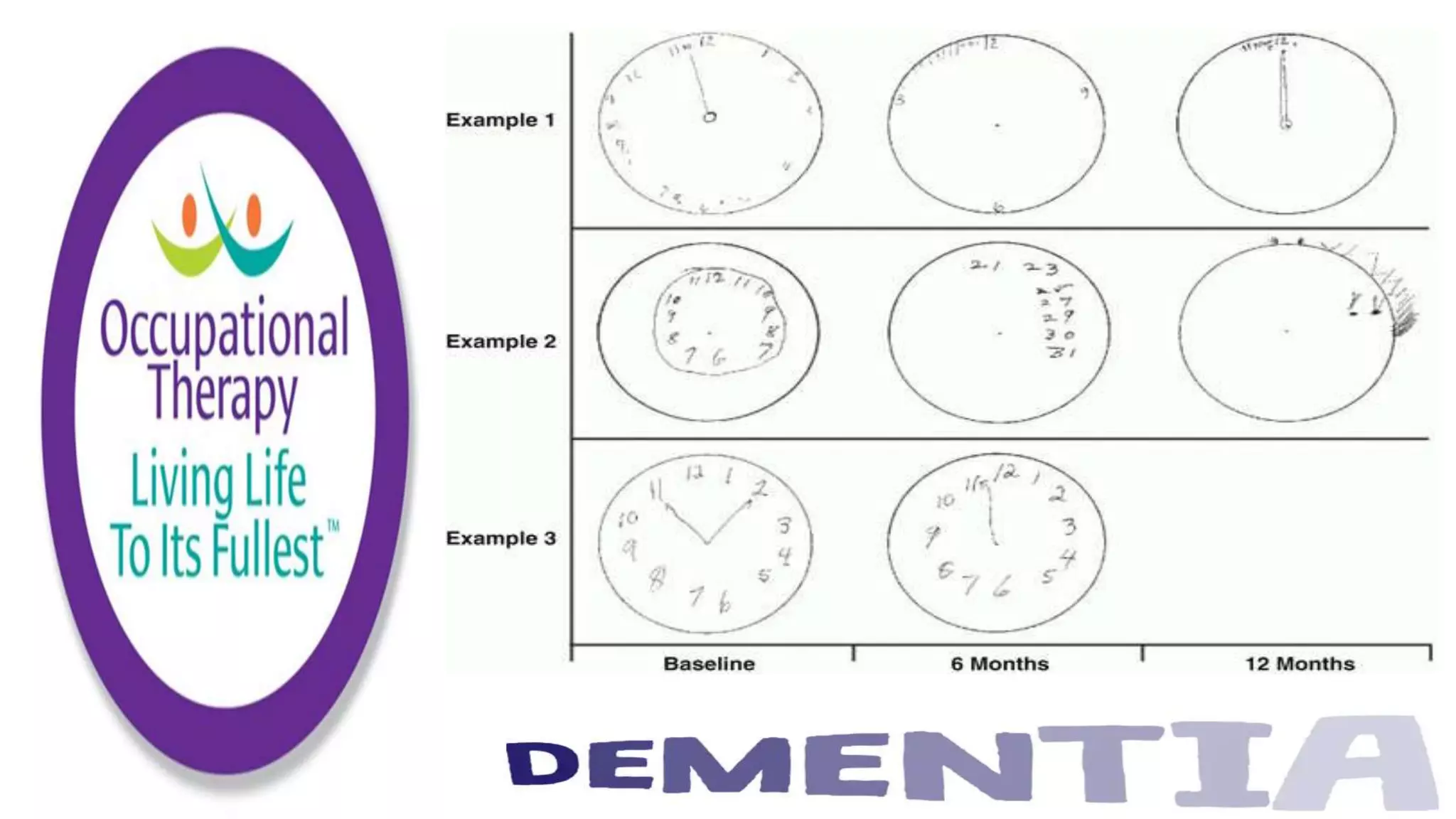 Occupational Therapy and Dementia Care part 2