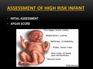 ASSESSMENT OF HIGH RISK INFANT
• INITIAL ASSESSMENT
• APGAR SCORE
 