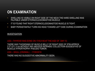 ON EXAMINATION
• SWELLING IS VISIBLE ON RIGHT SIDE OF THE NECK THE HARD SWELLING WAS
PALPABLE UNDER STERNOCLEIDOMASTOID MUSCLE.
• IT IS FOUND THAT RIGHT STERNOCLEIDOMASTOID MUSCLE IS TIGHT.
• BABY PERSISTANTALY TURN HIS HEAD TOWARD LEFT SIDE DURING EXAMINATION
INVESTIGATION
USG –THYROID WAS DONE ON 17/6/2106 AT THE AGE OF DAY 15.
THERE WAS THICKENING OF MUSCLE BELLY OF RIGHT SIDE OF STM APPROX
2.2*1.8*1.2 cm WITHOUT ANY ABVIOUS INTRINSIC COLLECTION-SUGGESTIVE OF
MUSCLE HYPERTROPHY /PSEUDO TUMOR.
USG – SKULL (CRANIAL) - 17/06/2016
THERE WAS NO SUGGESTIVE ABNORMALITY SEEN.
 