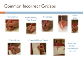 Common Incorrect Grasps
                                                     Tower
 Thumb Wrap       Index tucked,     Trap Grasp
                                                     Grips
                    Trap Grasp




   Fisted Grasp      Extended Finger Grasp
                                                  Extended
                                                   Finger,
                                                 Ungrounded
                                                  Forearm
 
