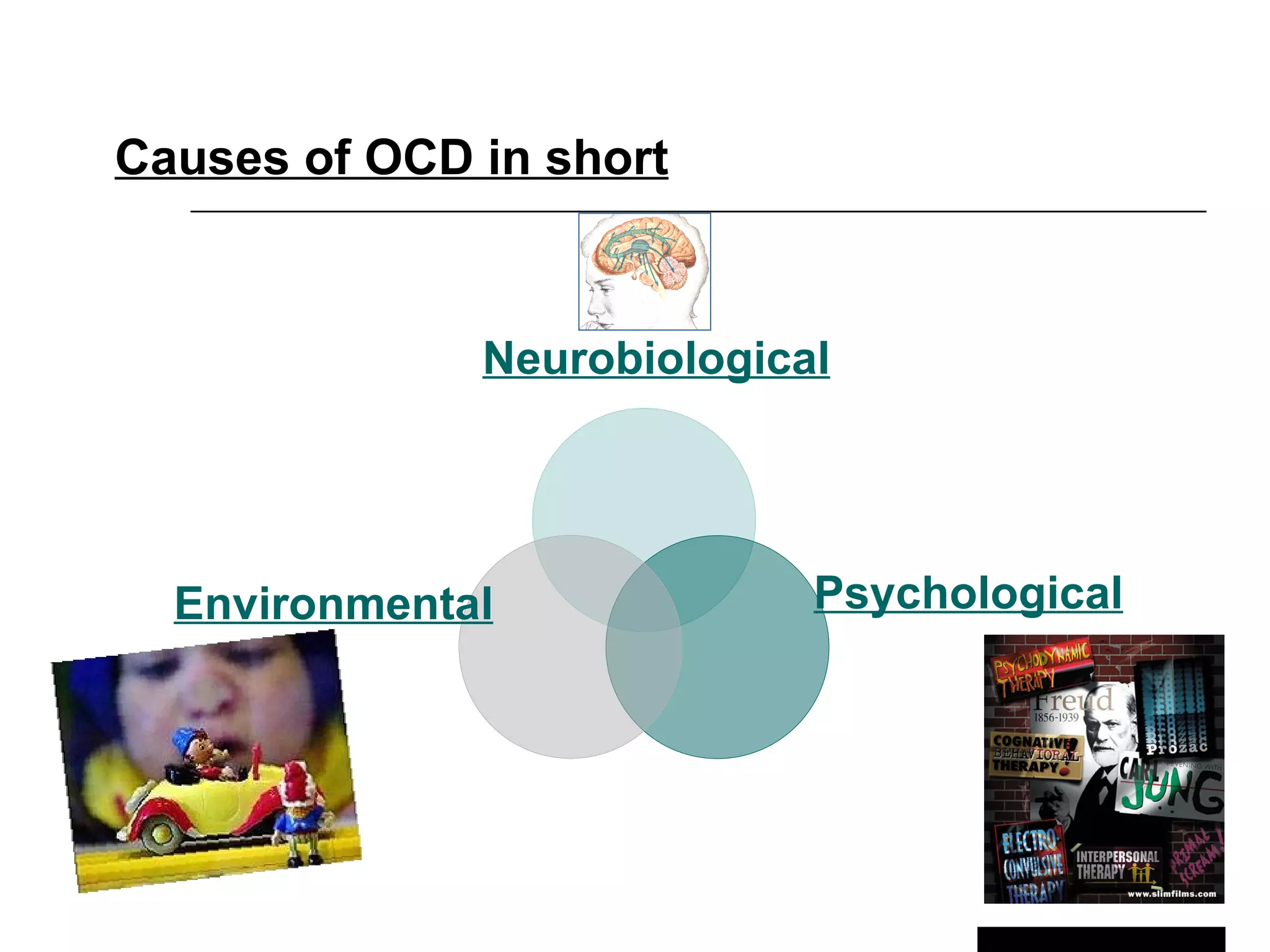 Ocd | PPT