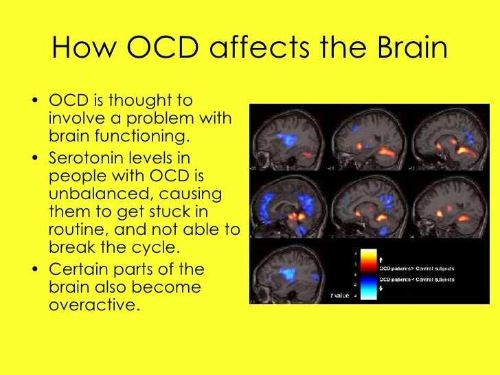 serotonin and ocd serotonin and ocd