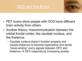 Obsessive-compulsive disorder | PPTX