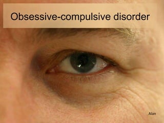 Obsessive-compulsive disorder




                            Alan
 