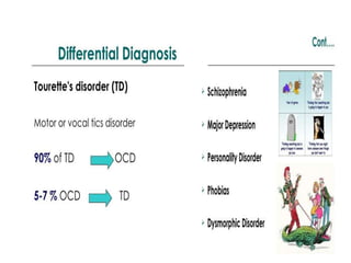 Ocd | PPTX