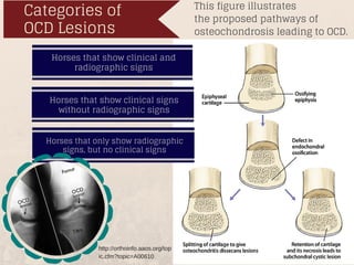 This figure illustrates
the proposed pathways of
osteochondrosis leading to OCD.
Categories of
OCD Lesions
Horses that show clinical and
radiographic signs
Horses that show clinical signs
without radiographic signs
Horses that only show radiographic
signs, but no clinical signs
http://orthoinfo.aaos.org/top
ic.cfm?topic=A00610