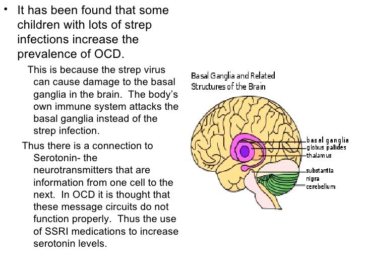 Childhood ocd case study