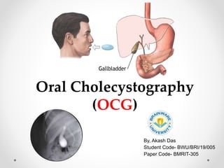 By, Akash Das
Student Code- BWU/BRI/19/005
Paper Code- BMRIT-305
Oral Cholecystography
(OCG)
 