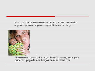 Mas quando passavam as semanas, eram somente
algumas gramas e poucas quantidades de força.




Finalmente, quando Dana já tinha 2 meses, seus pais
puderam pegá-la nos braços pela primeira vez.
 