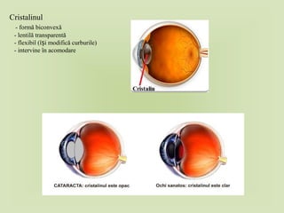 Cristalinul
- formă biconvexă
- lentilă transparentă
- flexibil (î i modifică curburile)ș
- intervine în acomodare
 