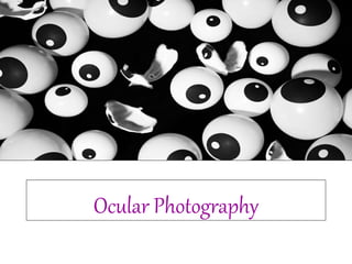 Ocular Photography
 