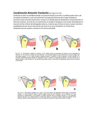 Combinación Rotación-Traslación (ver Fig.3.3 a 3.5):
Conforme se abre la mandíbula desde una posición de boca cerrada, el cóndilo puede rotar y de
inmediato trasladarse o caer verticalmente una pequeña distancia para luego trasladarse.
Durante la fase inicial de movimiento, el disco y el cóndilo parecen desplazarse conjuntamente en
dirección anterior. Al inicio de un movimiento, el cóndilo se desplaza a una mayor velocidad por la
tracción del haz inferior del pterigoideo externo, mientras que el disco lo hace un poco más lento
probablemente por las las inserciones que tiene en la zona retrodiscal. En la fase final,
ambasestructuras vuelven a moverse a la misma velocidad.
 